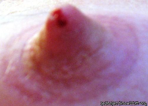My nipple bleeding after removing the pin.