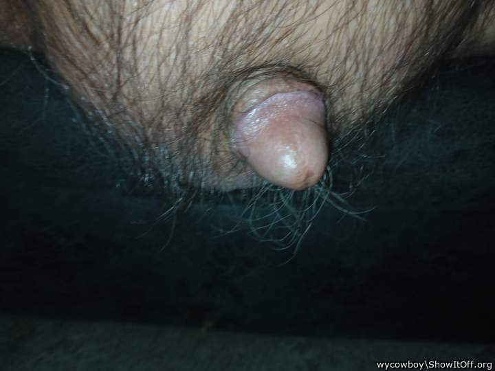 My nub