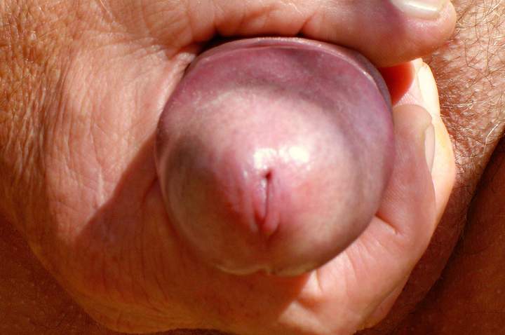 Photo of a penile from cuddles1
