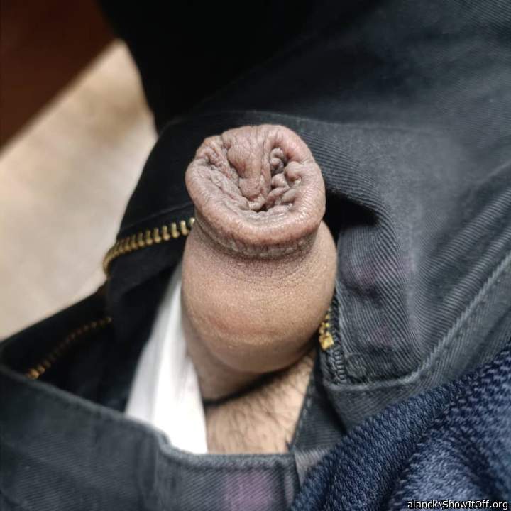 wow! you have a lot of extra skin, careful with the zipper