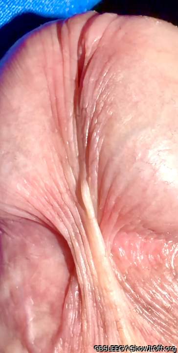 How many stretch marks can you see?