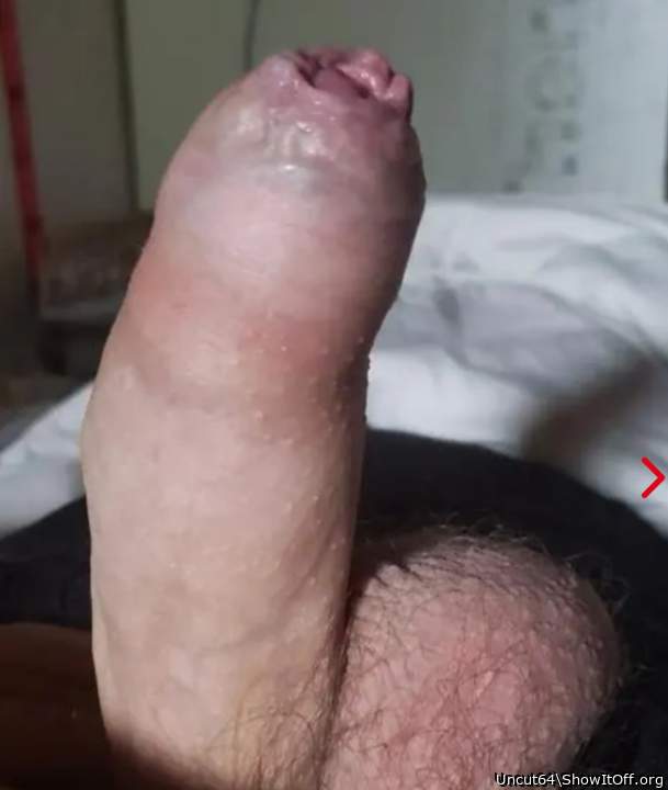 Photo of a short leg from Uncut64