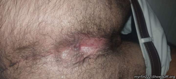 my hairy asshole