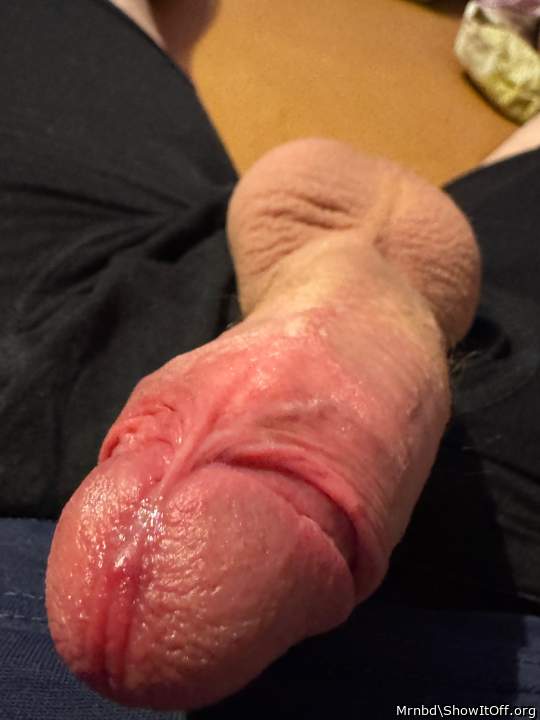 Photo of a short leg from Mrnbd