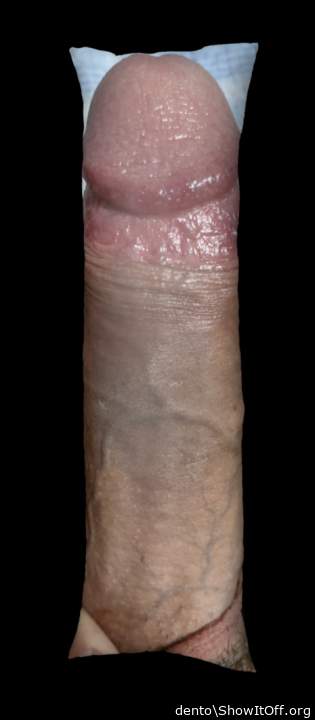 Photo of a middle leg from dento