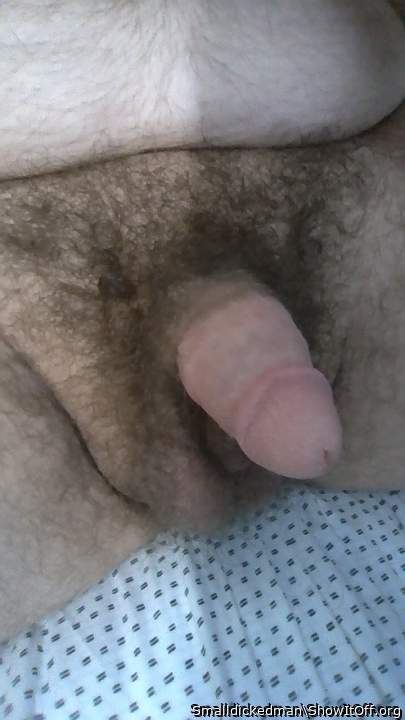 Photo of a short leg from Smalldickedman