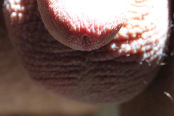 Photo of a phallus from lilsoftee