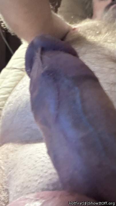 Photo of a phallus from Hotfire1$