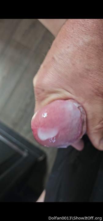 Photo of a middle leg from Dolfan0013