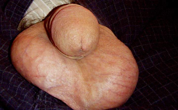 Testicles Photo from lilsoftee