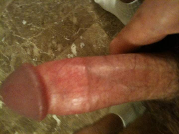 Photo of a penile from bdguy