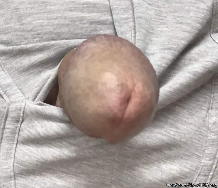 Photo of a private part from slow2cum