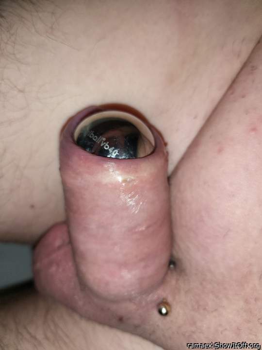 40 mm ball inside foreskin