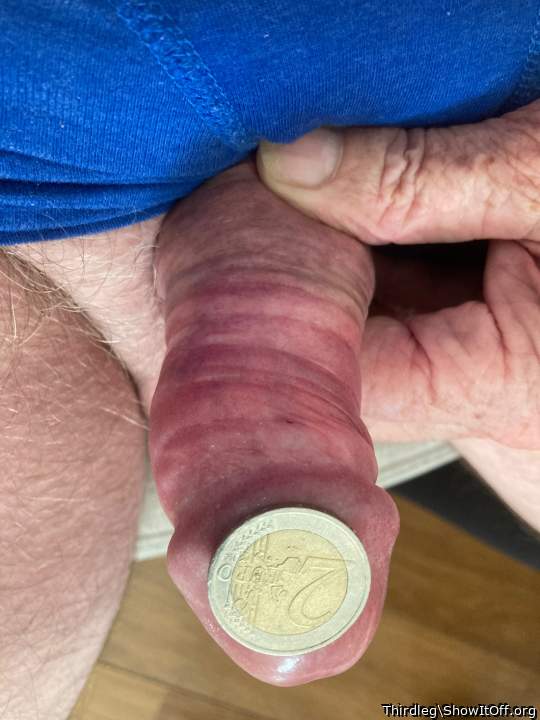 Photo of a penile from Thirdleg