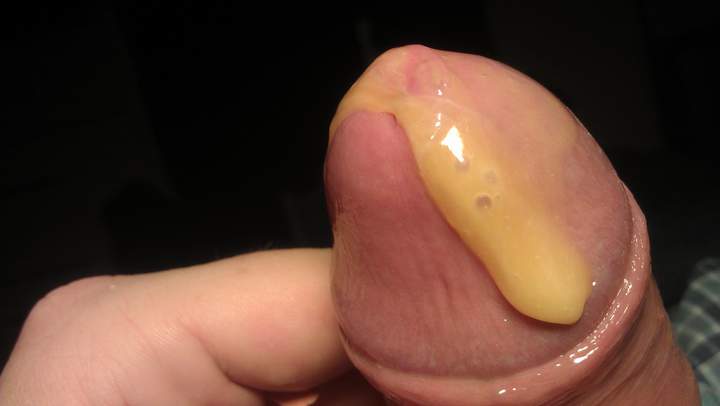 Photo of a penile from Vanillacum
