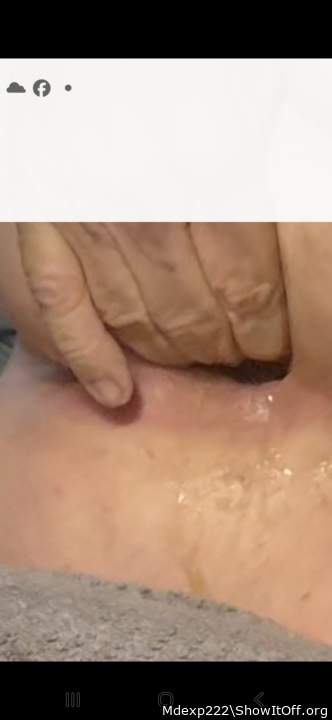 Photo of a prick from Mdexp222