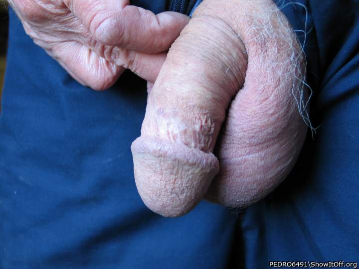 Photo of a short leg from PEDRO6491