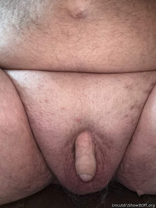 Photo of a private part from Uncutdi