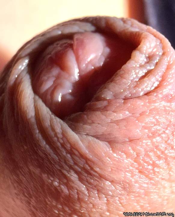 Foreskin Shot 2