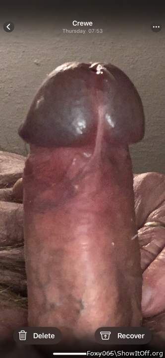 Photo of a penile from Foxy065