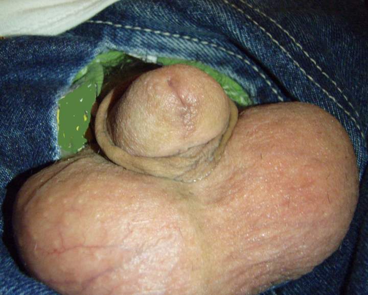 Testicles Photo from lilsoftee