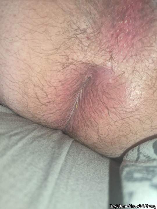 Photo of a penile from Try88me