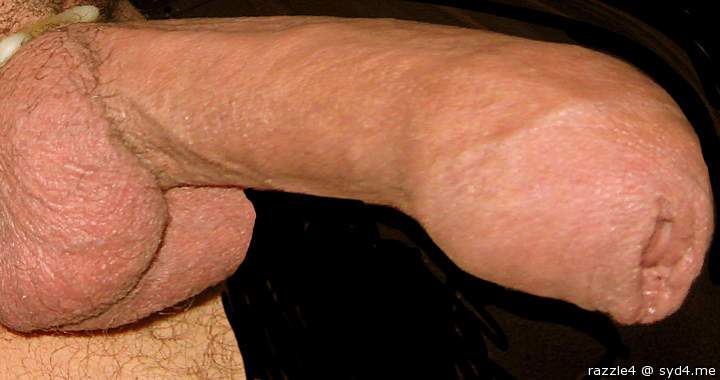That is one awesome foreskin. 