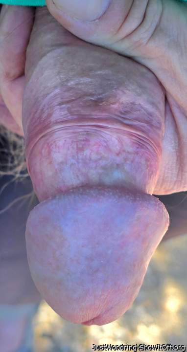 Photo of a schlong from JustWondring