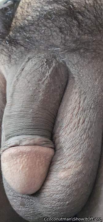 Photo of a prick from Ccoconutman