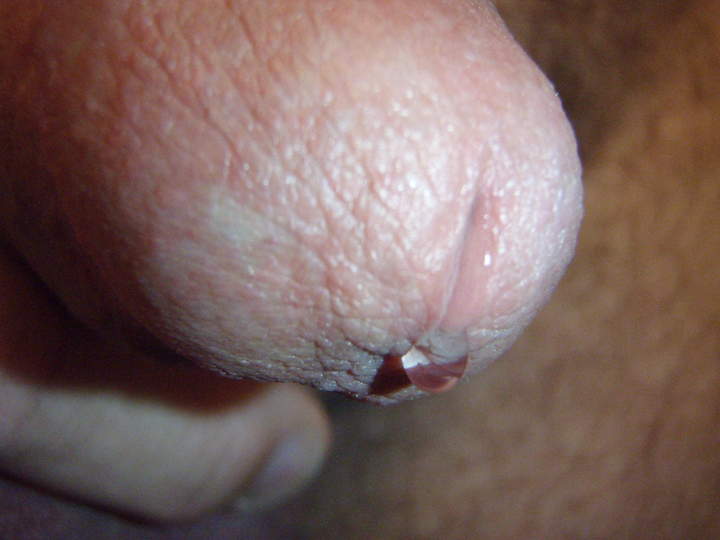Photo of a penile from lilsoftee