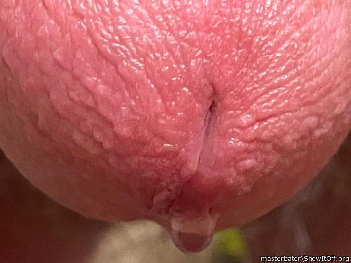 Photo of a penile from masterbater