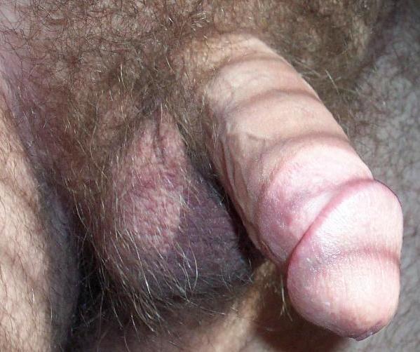 Photo of a penile from lilsoftee