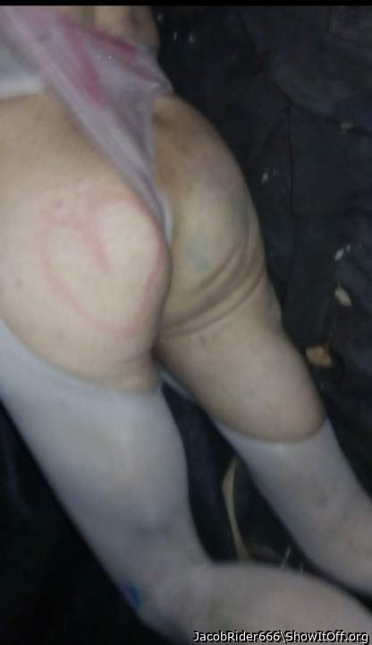 Photo of a middle leg from JacobRider666