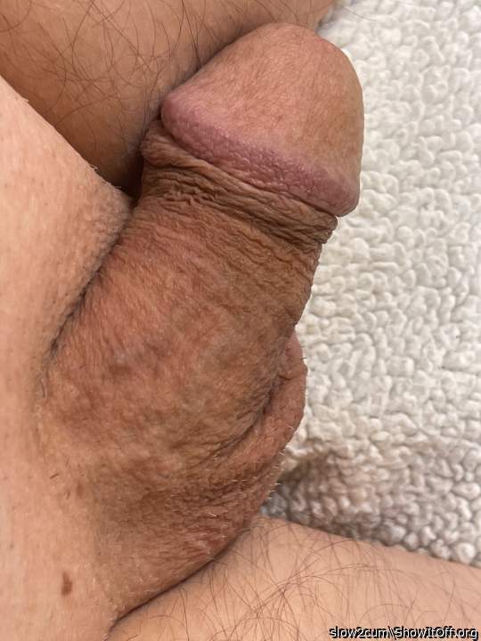 Needs attention 😊