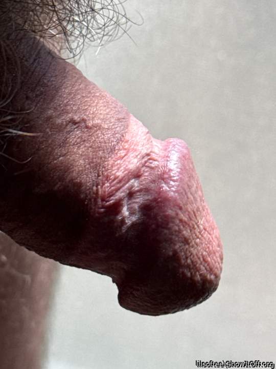 Photo of a short leg from lilsoftee
