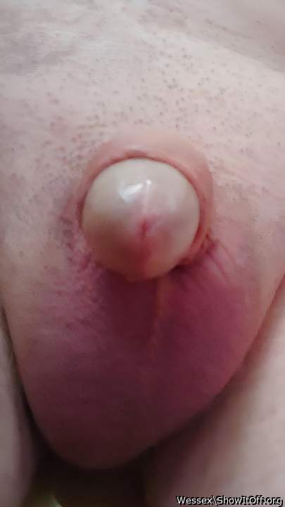 Photo of a prick from Wessex