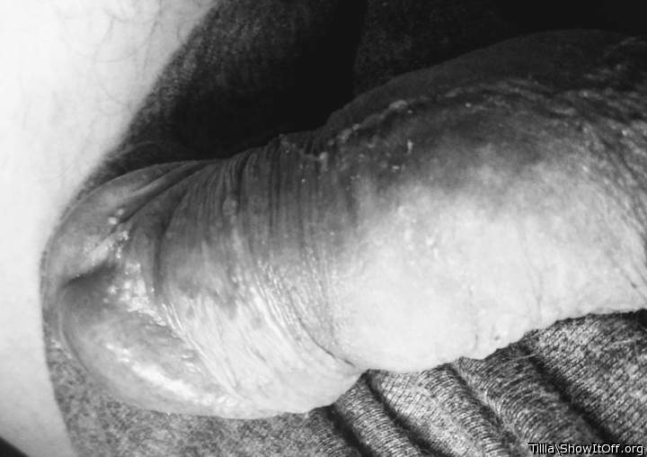 Photo of a penile from Tillla