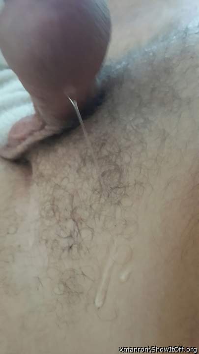 Photo of a penis from xmanron