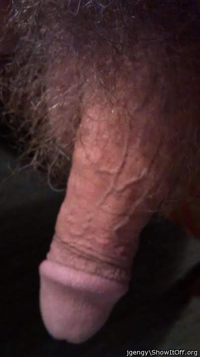 Photo of a penile from jgengy