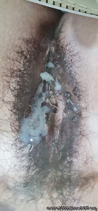 Photo of a penile from metro1000