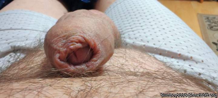 Photo of a middle leg from Slimboy2026