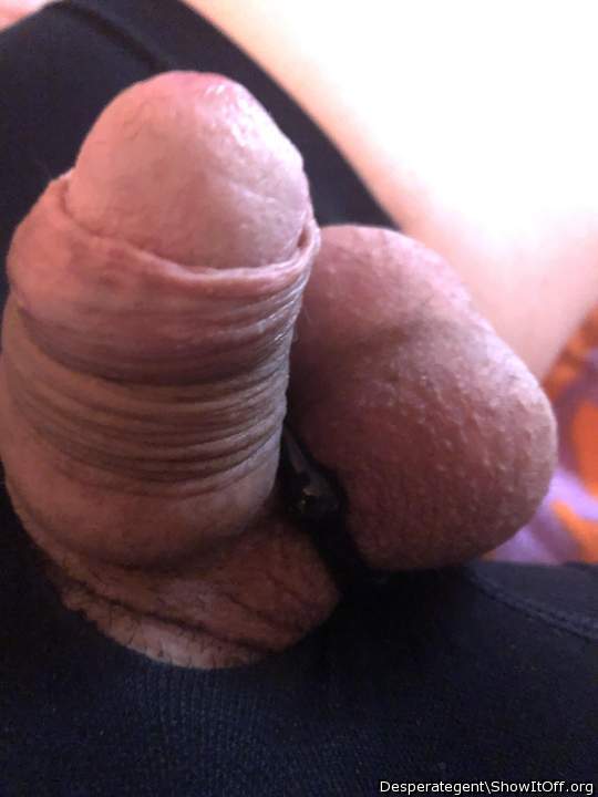 Photo of a penile from Desperategent