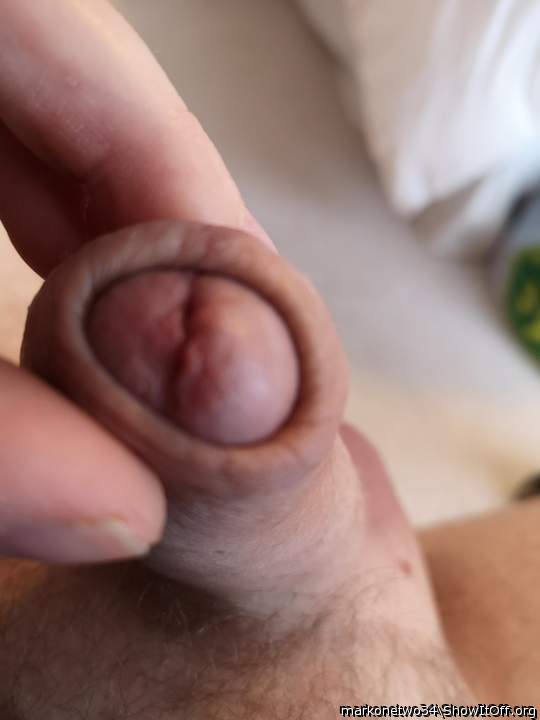 Photo of a penile from markonetwo34