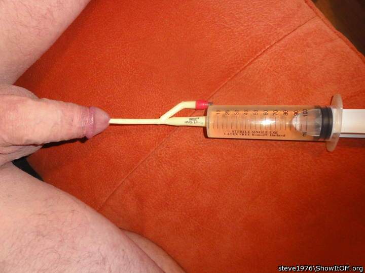 Catheter Bladder Fill