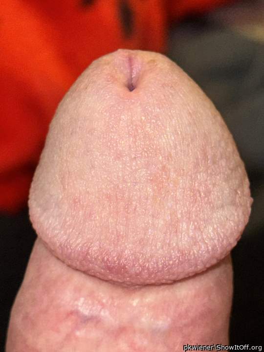 Photo of a penis from pkwiener