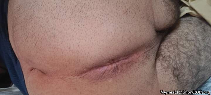 Photo of a phallus from Mymeat11