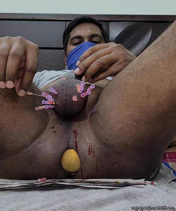 16 needles in my balls
