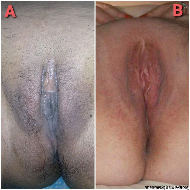 Choose A Or B