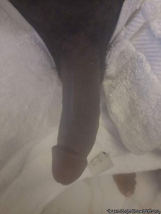 Photo of a short leg from dkasmithgh