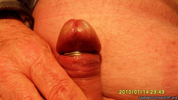 Penis with frenulektomy and 3 Goldrings